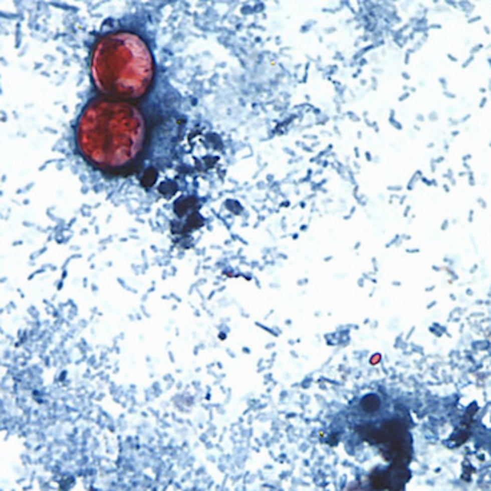 La enfermedad provoca diarrea y otros síntomas gastrointestinales.