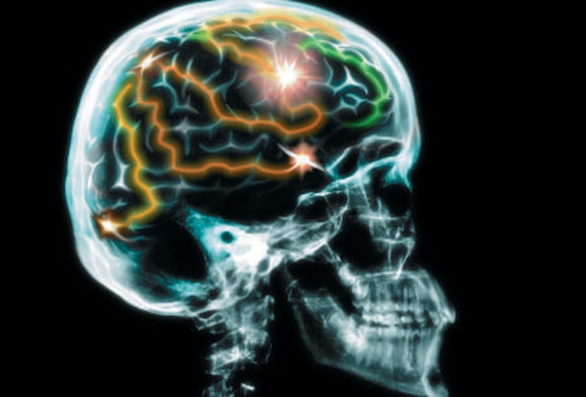 También podría beneficiar a quienes sufren de la condición de Lou Gehrig.  <font color="yellow">(Archivo)</font>