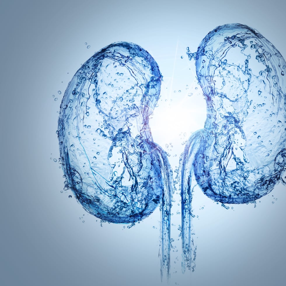 Cuando el paciente tiene un 15 % de filtración es cuando puede tener síntomas.