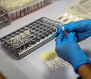 Según el estudio, el tratamiento con los bacteriófagos podrían ser una opción terapéutica "prometedora" para las infecciones multirresistentes a los antibióticos.