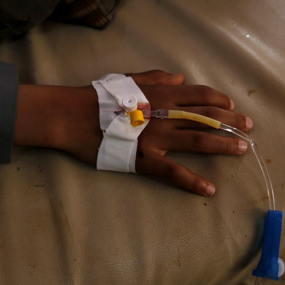 Imagen de archivo de un niño yemení infectado con cólera en medio de un brote que se propaga rápidamente recibe tratamiento en un hospital.