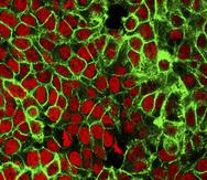 Imagen de microscopio difundida por el Centro Nacional de Investigación del Cáncer de EEUU en 2015 muestra células cancerosas de colon teñidas de rojo. Un panel de expertos recomienda iniciar los tests de cáncer de colon a los 45 años en lugar de 50.