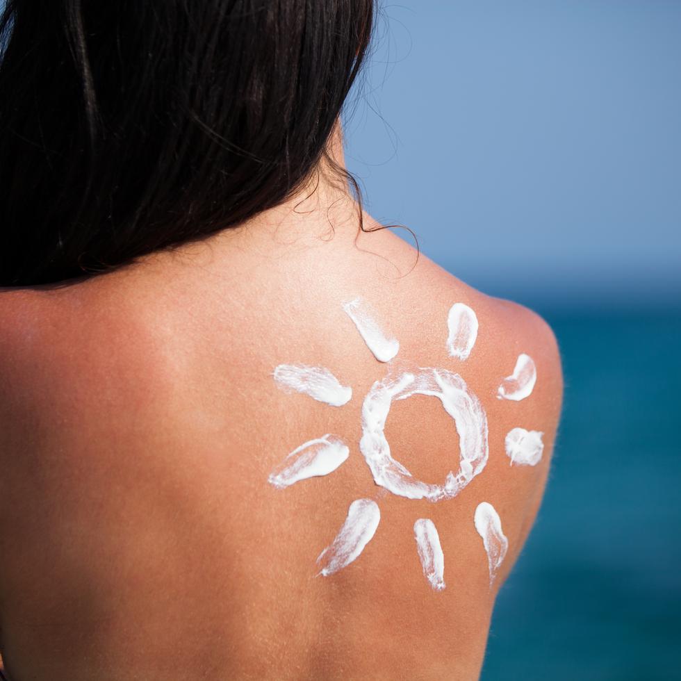 Una manera de prevención es conocer tu piel, identificar si existe algún cambio con la presencia de manchas, lunares y pecas. (Shutterstock)
