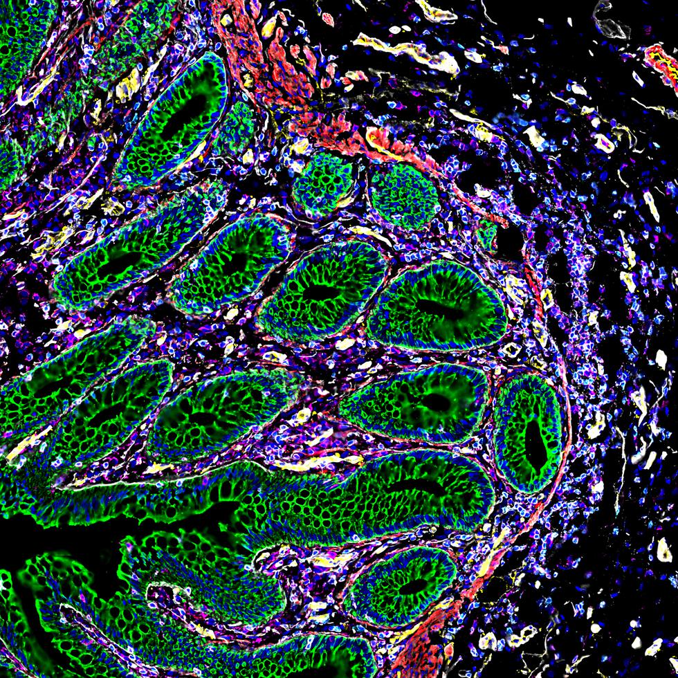 Imagen de las células del intestino, lograda con microscopía y tecnología robótica. Los colores representan moléculas específicas dentro de los diferentes tipos de células.
