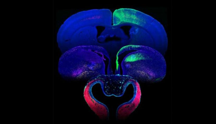 Imágenes de fluorescencia de cortes de cerebro de serpiente (frente), pollo (intermedio) y ratón (detrás) ilustrando las diferencias en grosor, tamaño y cantidad de neuronas en la corteza cerebral (verde). (Instituto de Neurociencias de Alicante)