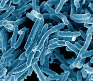 La bacteria que causa la tuberculosis dispone de un mecanismo que bloquea la respuesta inmunitaria cuando infecta a un organismo. (NIH Flickr)