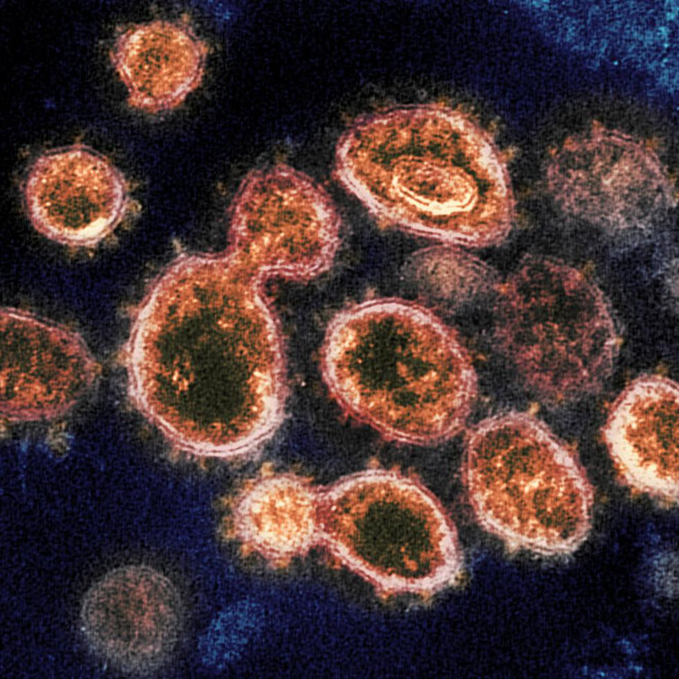 ARCHIVO - Esta imagen captada con un microscopio electrónico y proporcionada por el Instituto Nacional de Alergias y Enfermedades Infecciosas muestra partículas del virus SARS-CoV-2 que causan el COVID-19 aisladas de un enfermo en Estados Unidos. (NIAID-RML vía AP)