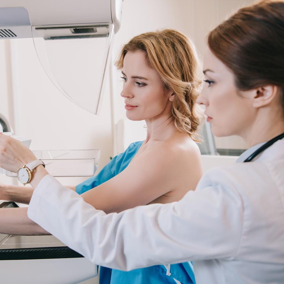 Entre los requisitos, las mujeres interesadas deben haber pasado más de un año de haberse hecho la última mamografía. (Shutterstock)