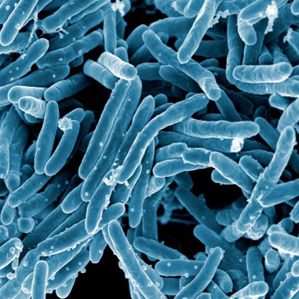 La bacteria que causa la tuberculosis dispone de un mecanismo que bloquea la respuesta inmunitaria cuando infecta a un organismo. (NIH Flickr)