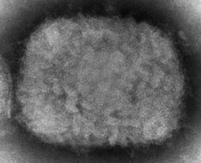 Imagen microscópica de un virión de la viruela del mono.