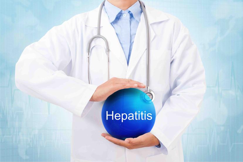 Hay varios tipos de infecciones virales de hepatitis. Los tipos más comunes son hepatitis A, B y C, y recientemente se han podido identificar los virus de hepatitis D y E. (Foto: Shutterstock.com)