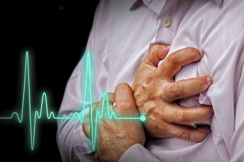Las probabilidades de sobrevivir un paro cardiaco súbito disminuyen hasta ser casi nulas si el paciente no recibe la debida atención médica durante los primeros 10 minutos del evento. (Thinkstock)